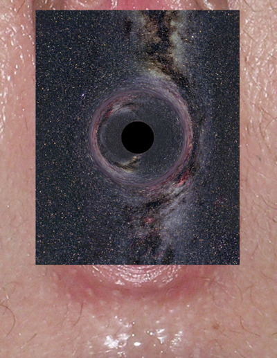 Rugae vaginales with black hole