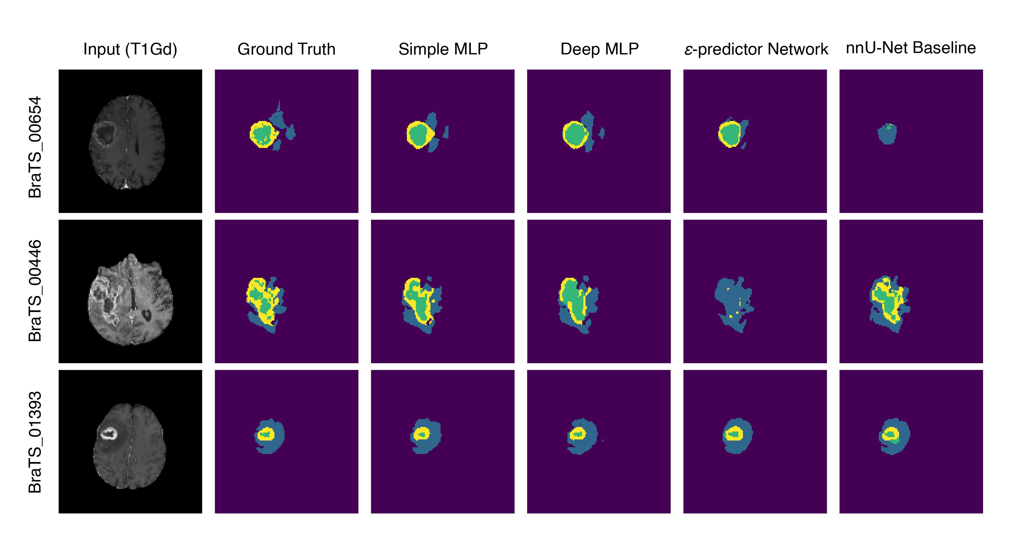 Generated 128 x 128 BraTS samples